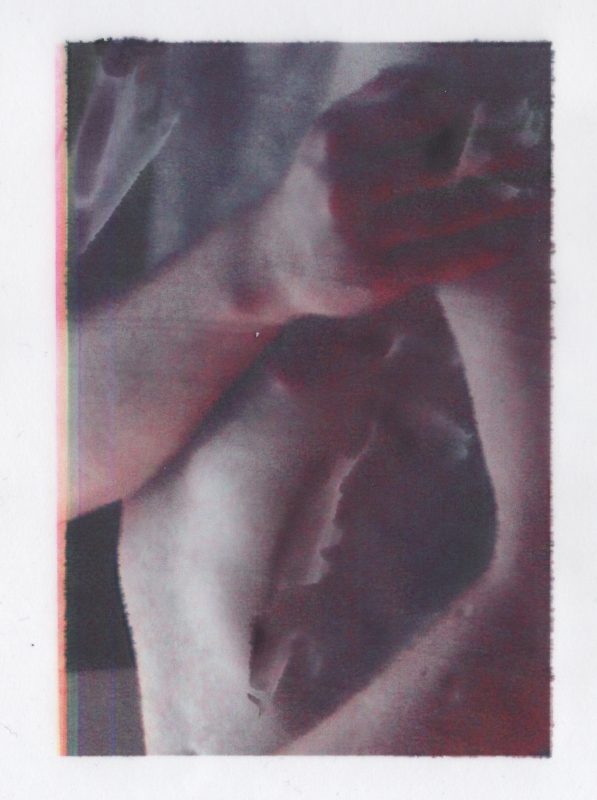 blessure s_imprime, photographie numérique sur calque, 2019